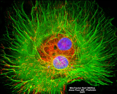 Fluorescence microscopy image