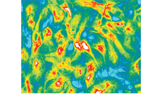 Fluorescence microscopy image