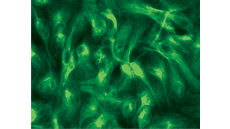 Fluorescence microscopy image