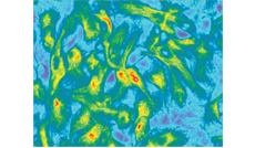 Fluorescence microscopy image