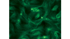Fluorescence microscopy image