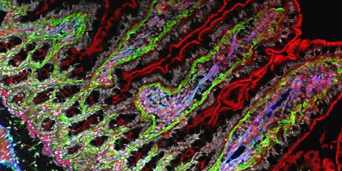 Fluorescence microscopy image