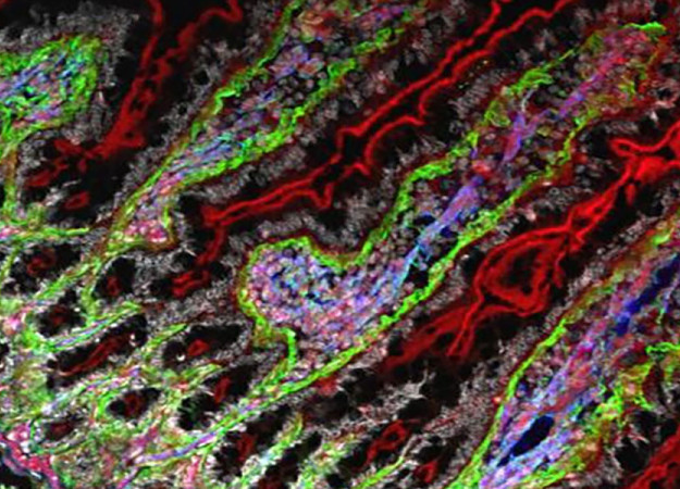 fluorescence microscopy cells red green purple